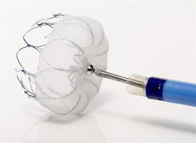 Watchman_1 Watchman Implant Sansum Clinic